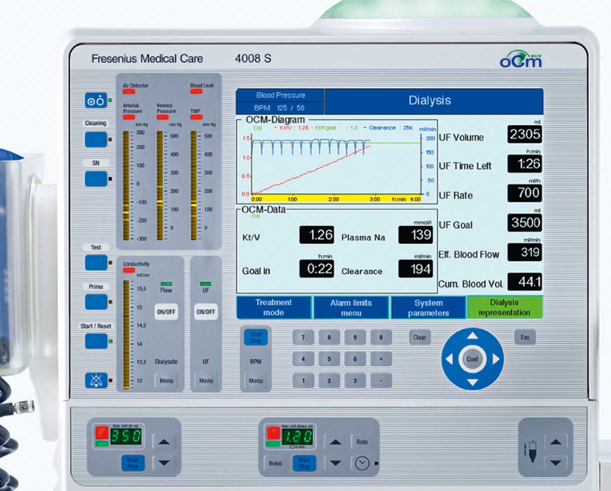 Configuración del OCM®